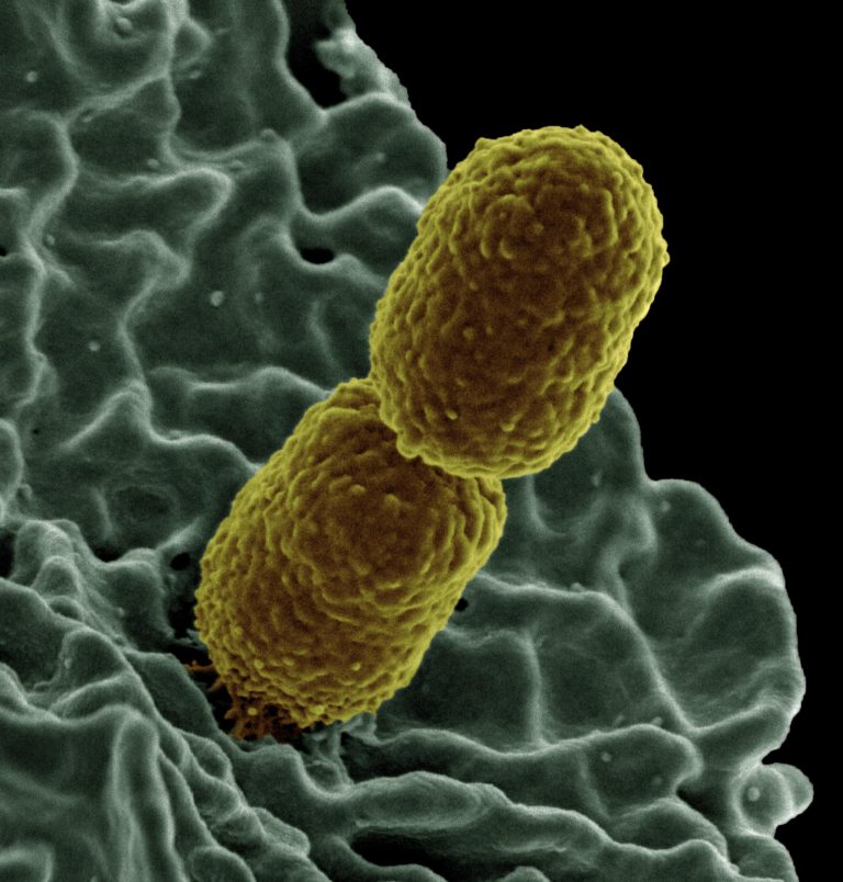 Multiresistente Bakterien – im Schatten von SARS-Cov2 - Novapura